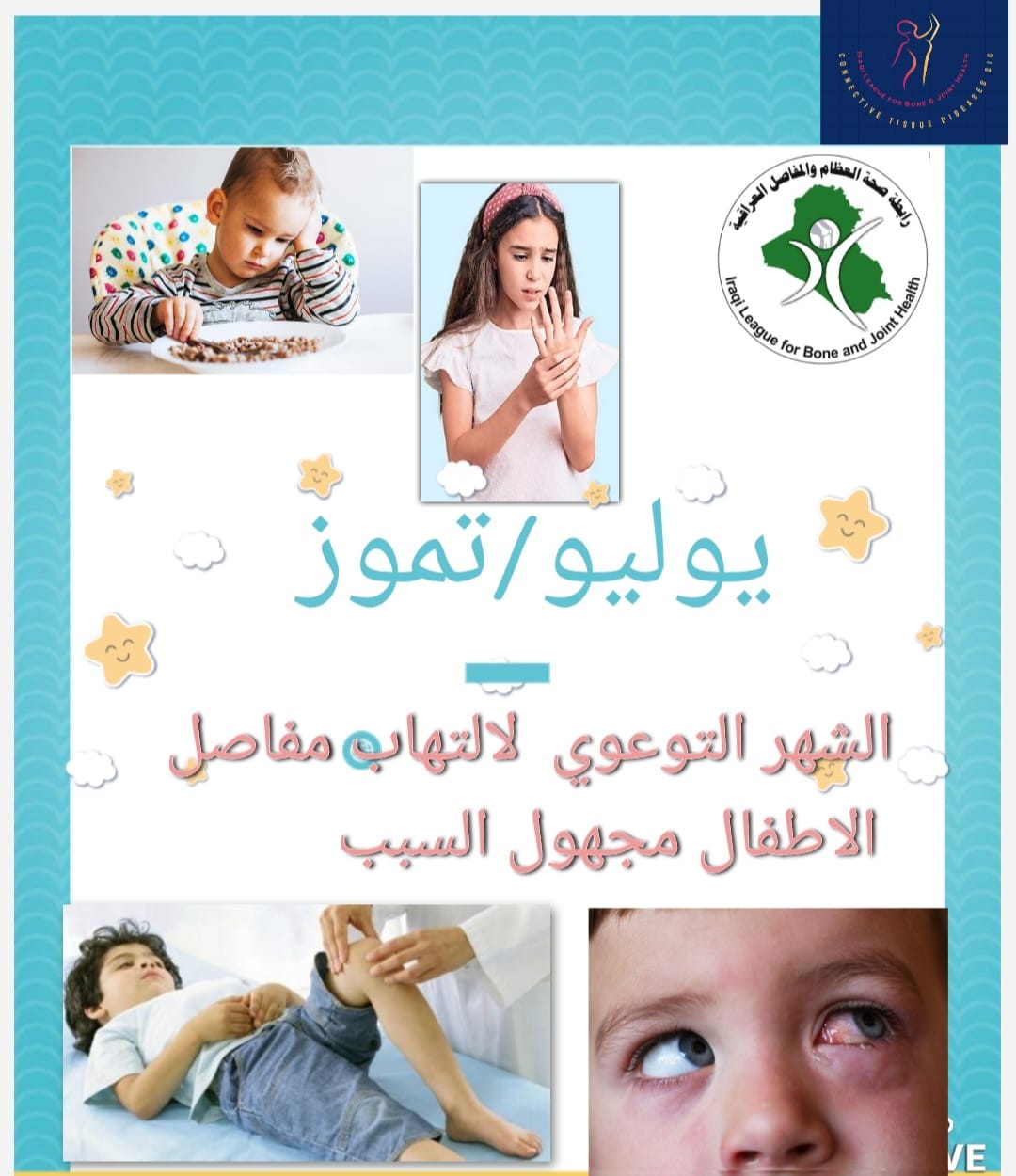 Juvenile Idiopathic Arthritis: Informative Poster by Dr. Elaf Raad for July Awareness Month