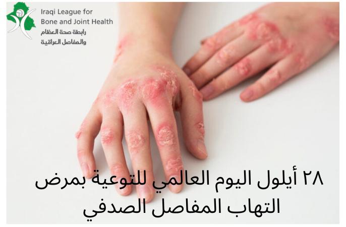 September 28, World Psoriasis and Psoriatic Arthritis Day
