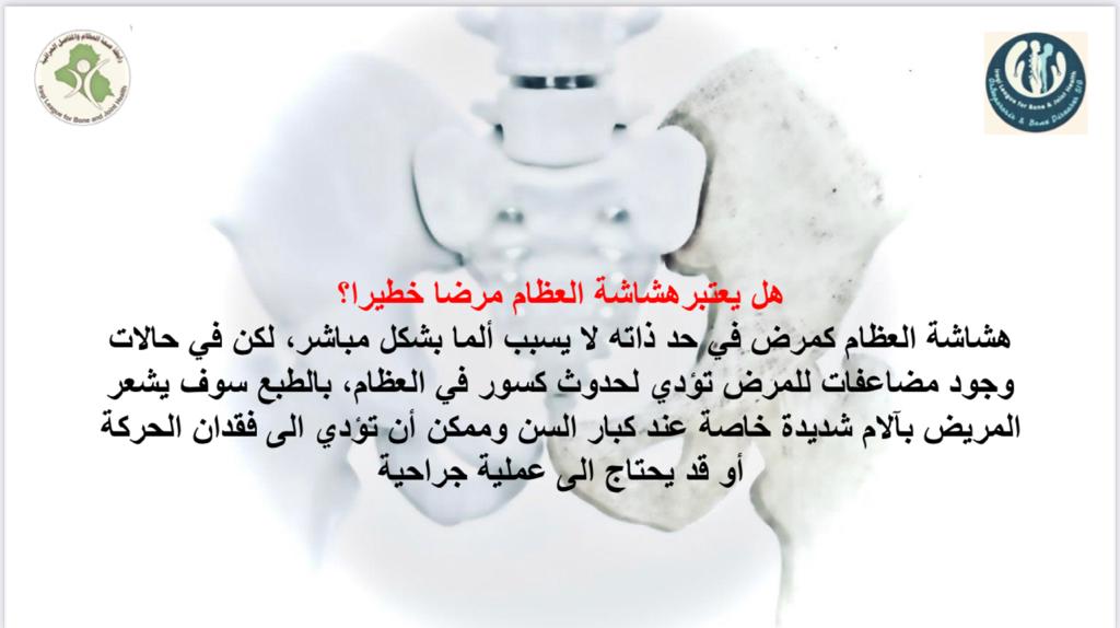 هل يعتبر هشاشة العظام مرضا خطيرا؟